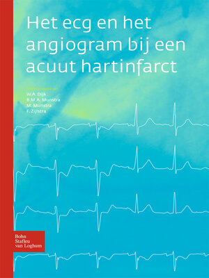 cover image of Het ecg en het angiogram bij een acuut hartinfarct